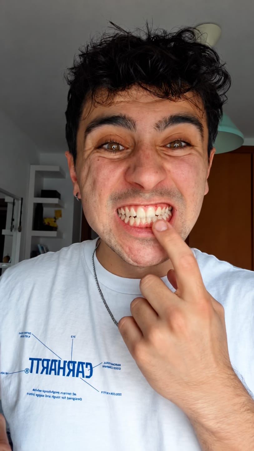 Customer photo review of CLUXO®—Blanqueador Dental V34