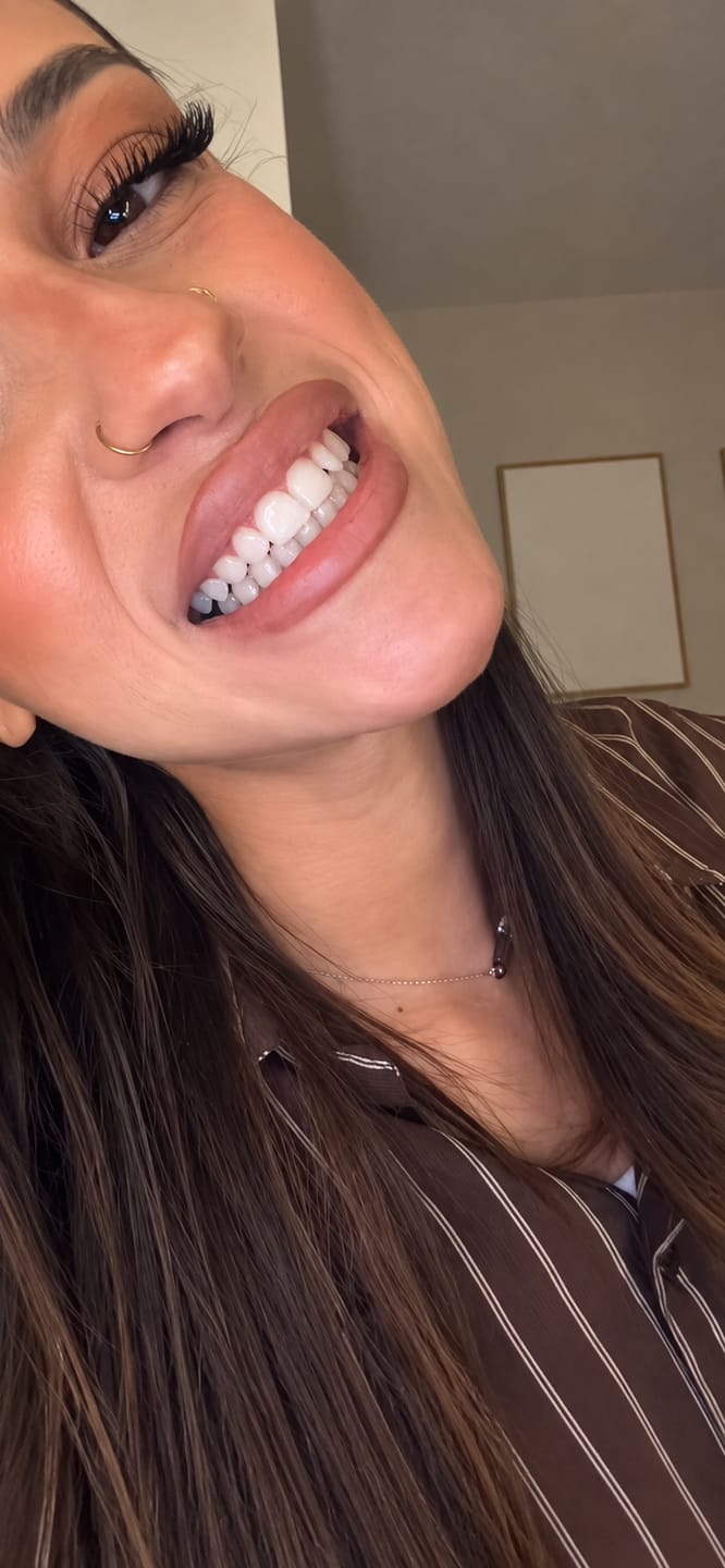 Customer photo review of CLUXO®—Blanqueador Dental V34