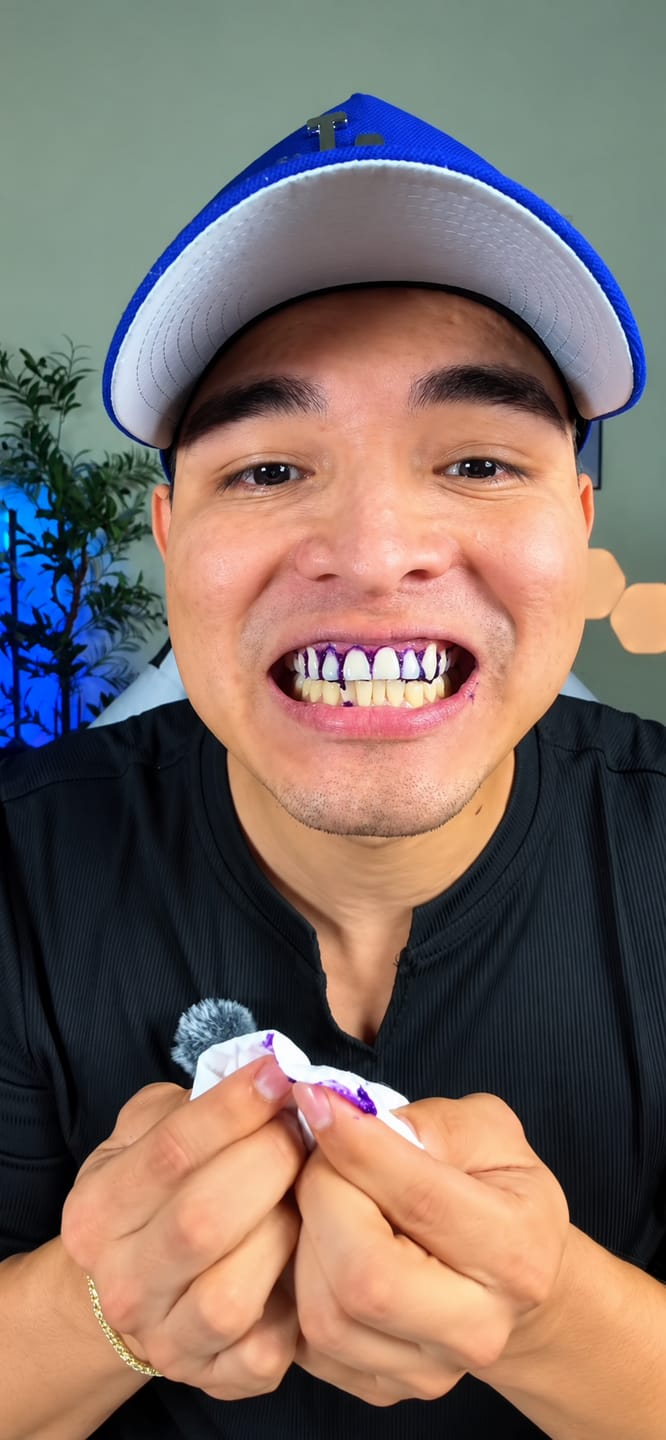 Customer photo review of CLUXO®—Blanqueador Dental V34