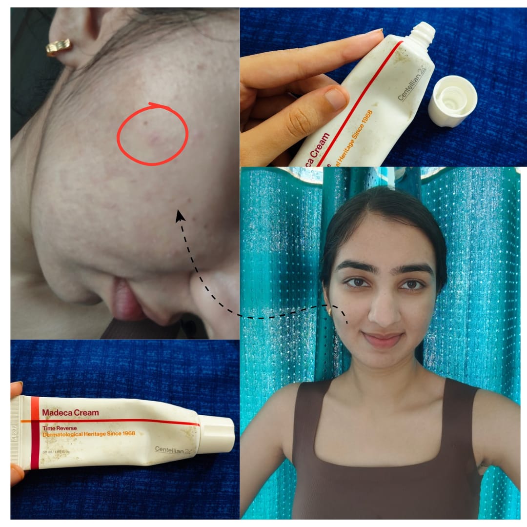 Customer photo review of Madeca Cream Time Reverse 50ml
