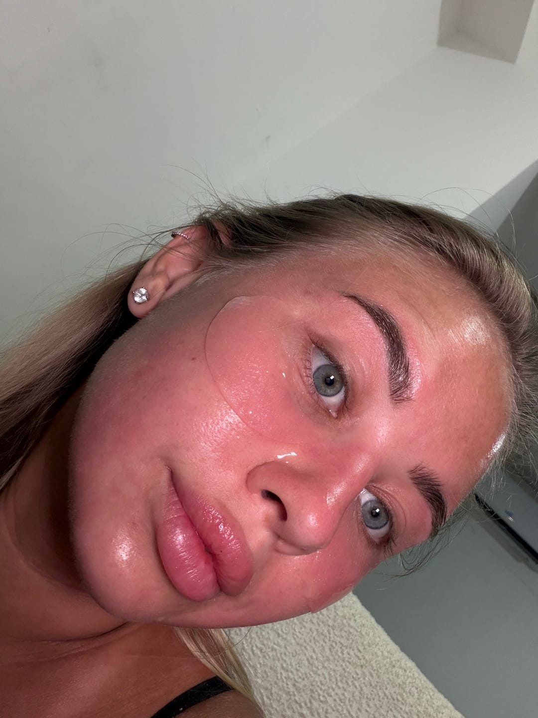 Customer photo review of PDRN retinal eye patch Glow jelly