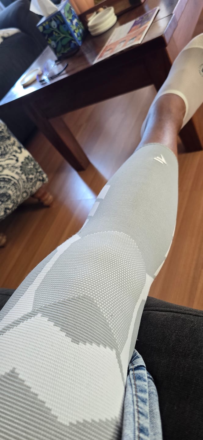 Customer photo review of Compression Sleeves V2 for Knees and Legs
