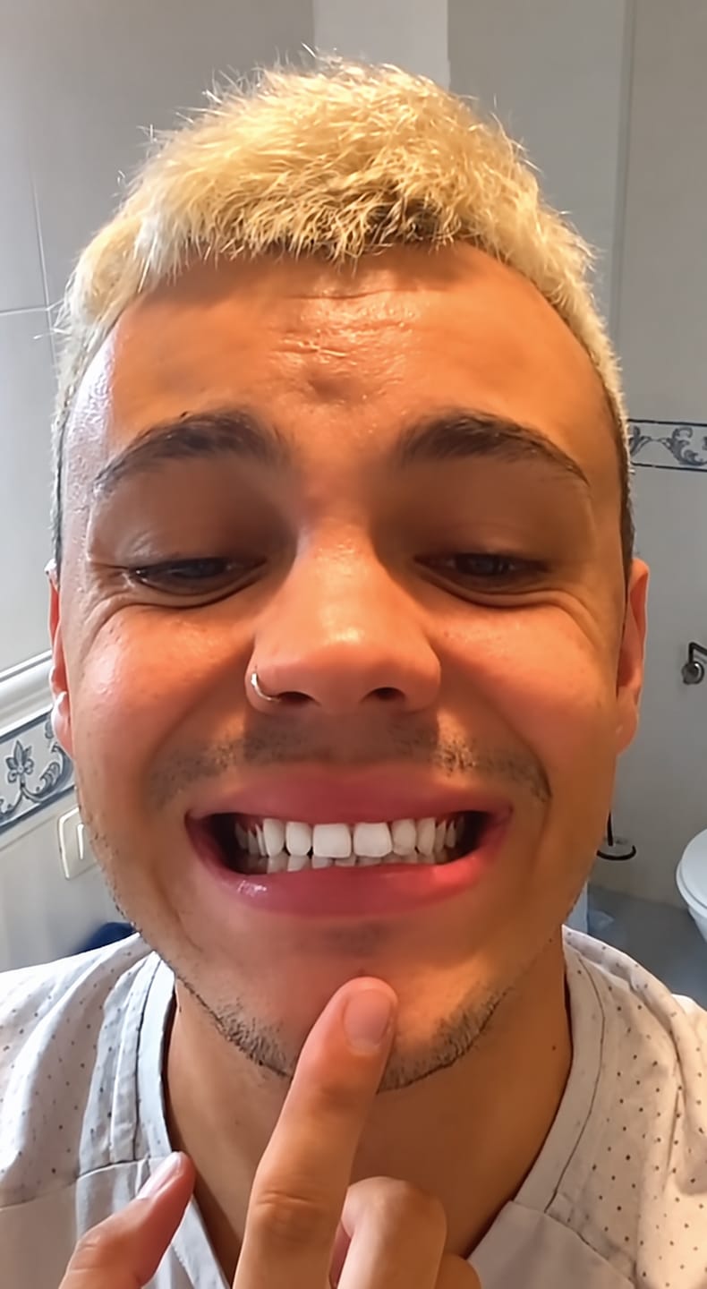 Customer photo review of CLUXO®—Blanqueador Dental V34