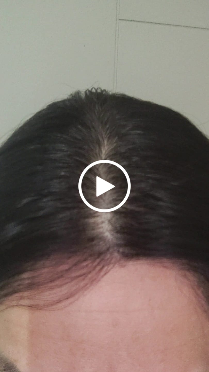 Customer video review of 3 MESES de DUO ANTIcaída capilar TÓNICO + BOMBA NUTRICIONAL | ENVÍO GRATIS