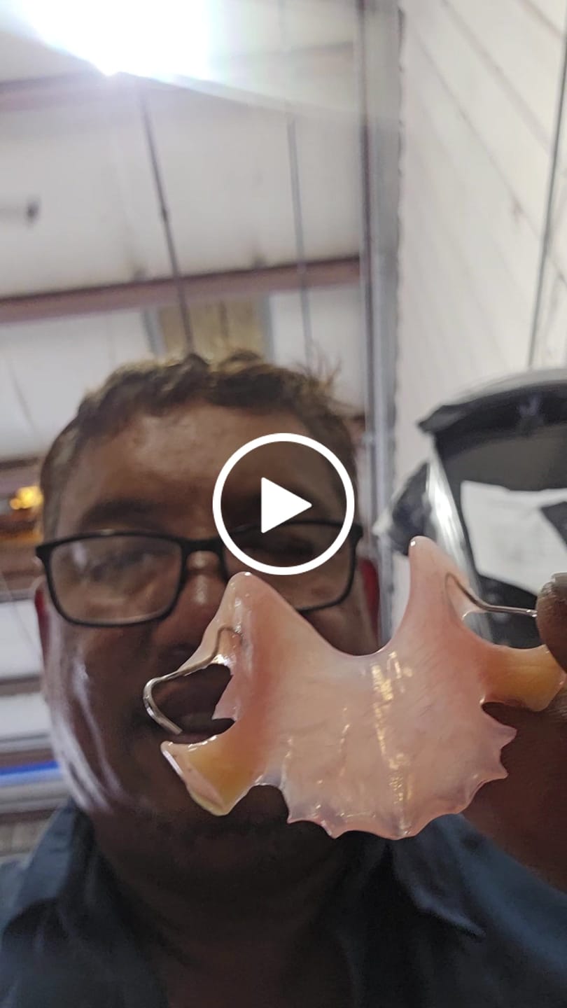 Customer video review of Acrylic Partial Flipper Denture