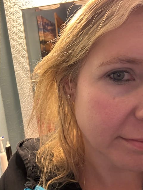 Customer photo review of ACTIVE PRO SERUM | ANTI-AGING
