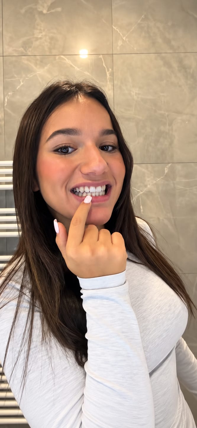 Customer photo review of CLUXO®—Blanqueador Dental V34