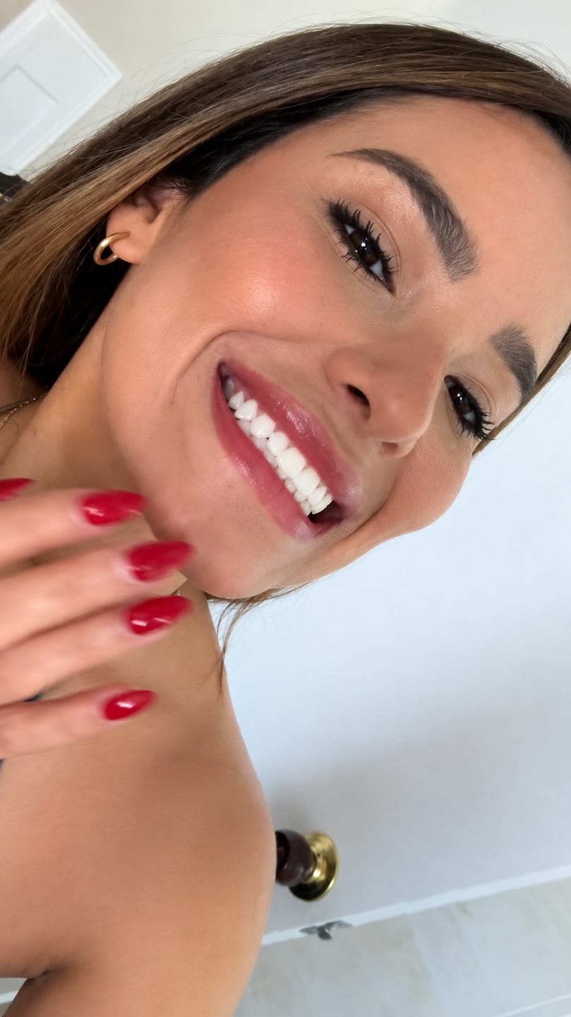 Customer photo review of CLUXO®—Blanqueador Dental V34