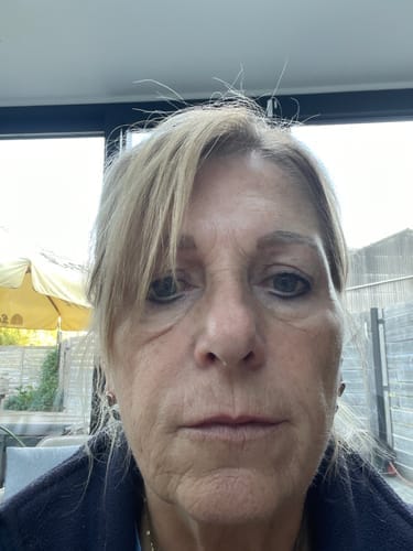Customer photo review of Bio-kollagenmaske + pensel