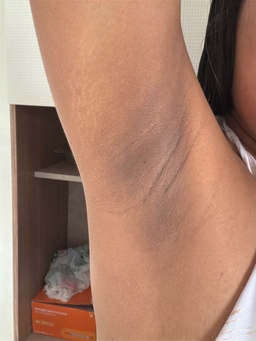 Customer photo review of Creme Clareador de Manchas – Melasma, Axilas, Virilha, Áreas Íntimas, Rosto e Corpo