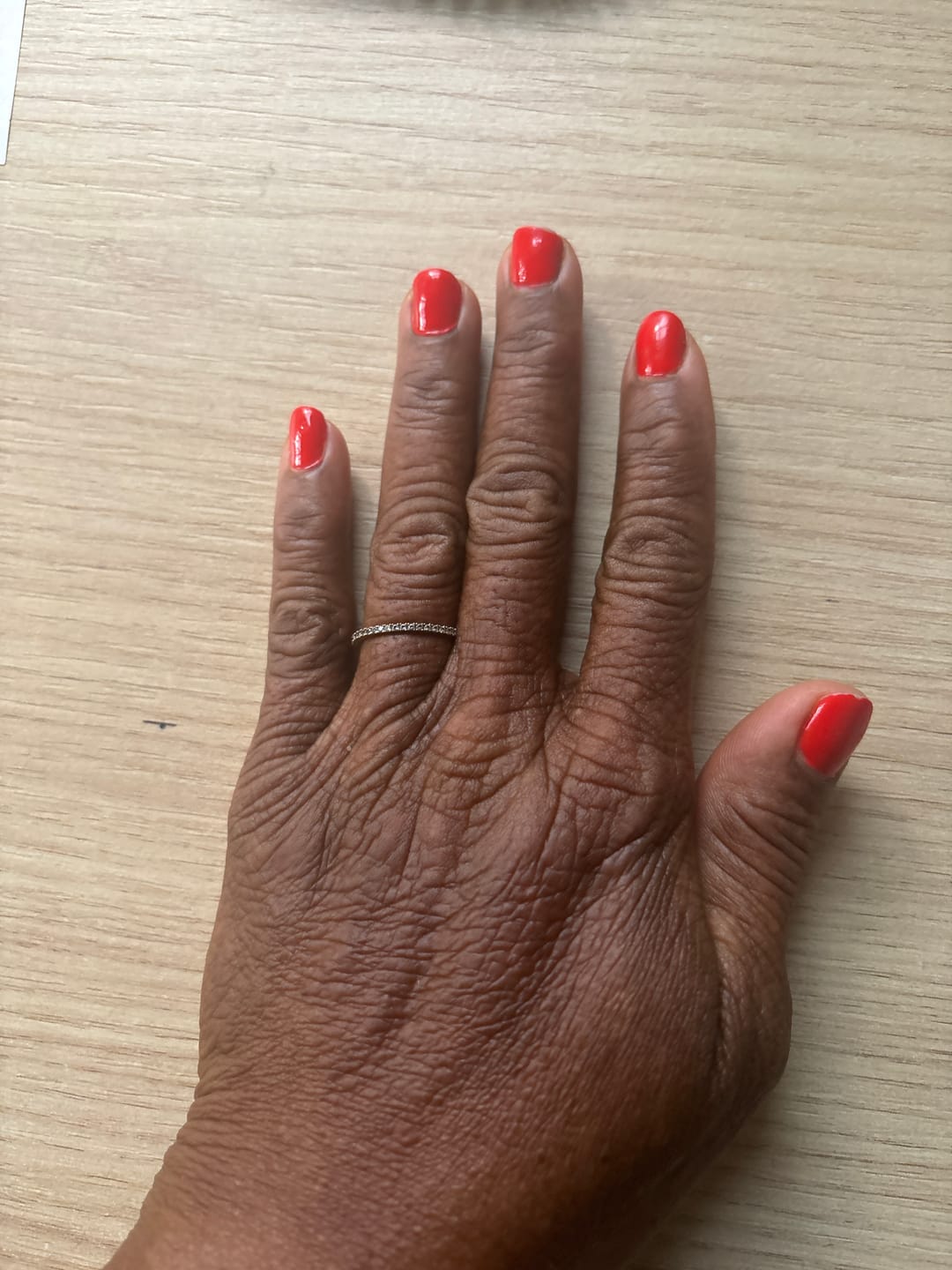 Customer photo review of SÉRUM CORRECTEUR CIBLÉ ANTI-QUINTOS