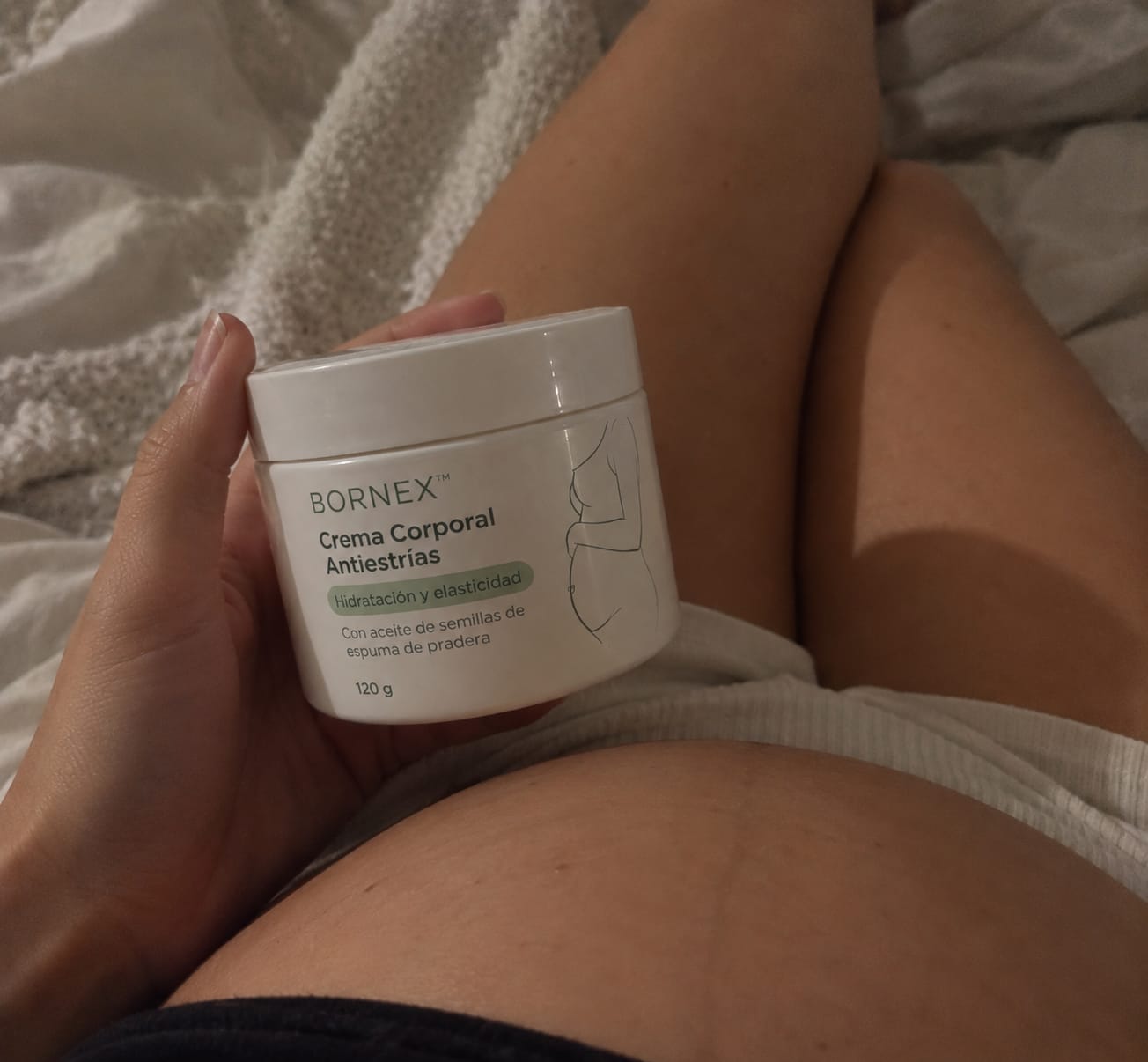 Customer photo review of Crema Antiestrías Bornex™