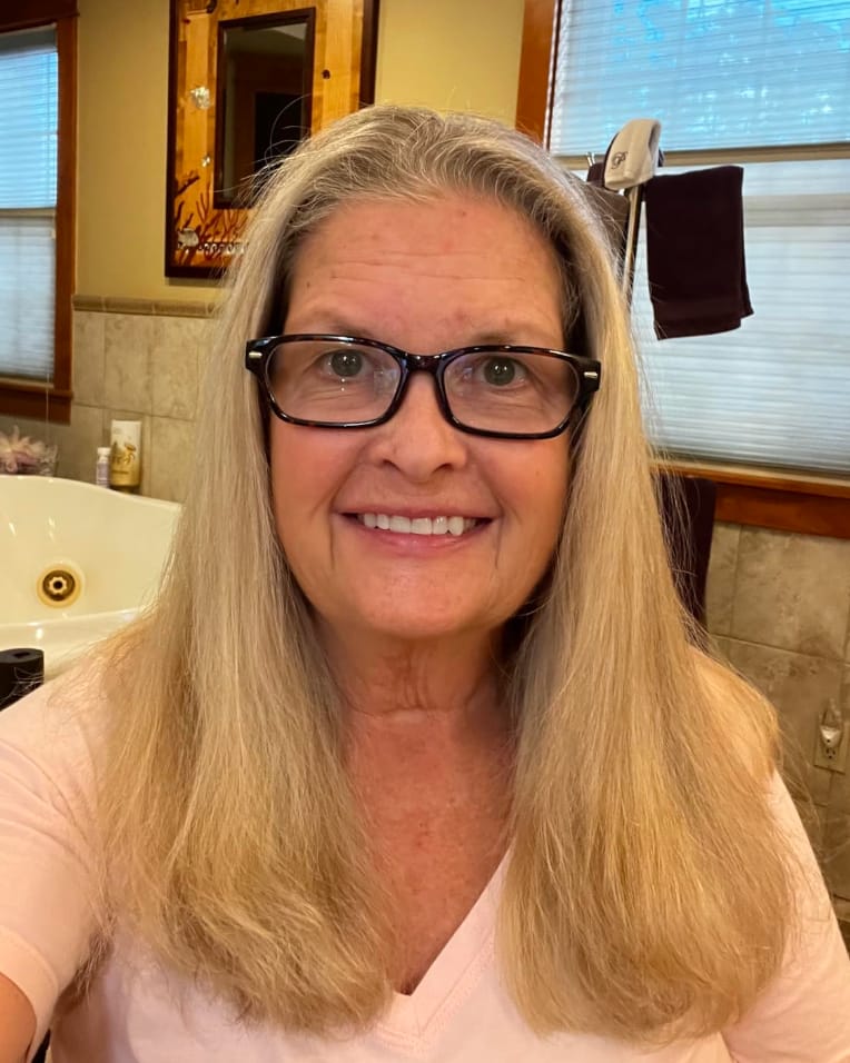 Customer photo review of Zilo™ Cabello perfecto en menos de 2 minutos.