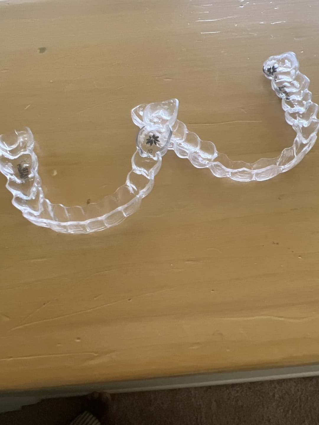Customer photo review of DentaSonic - UV Ultrasonic Denture & Retainer Cleaner