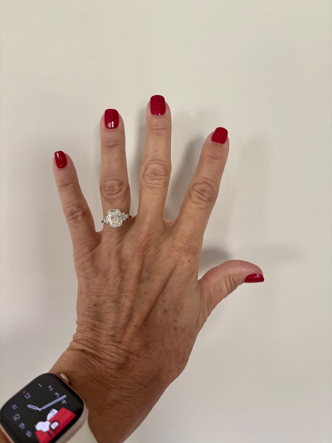Customer photo review of Arlet
