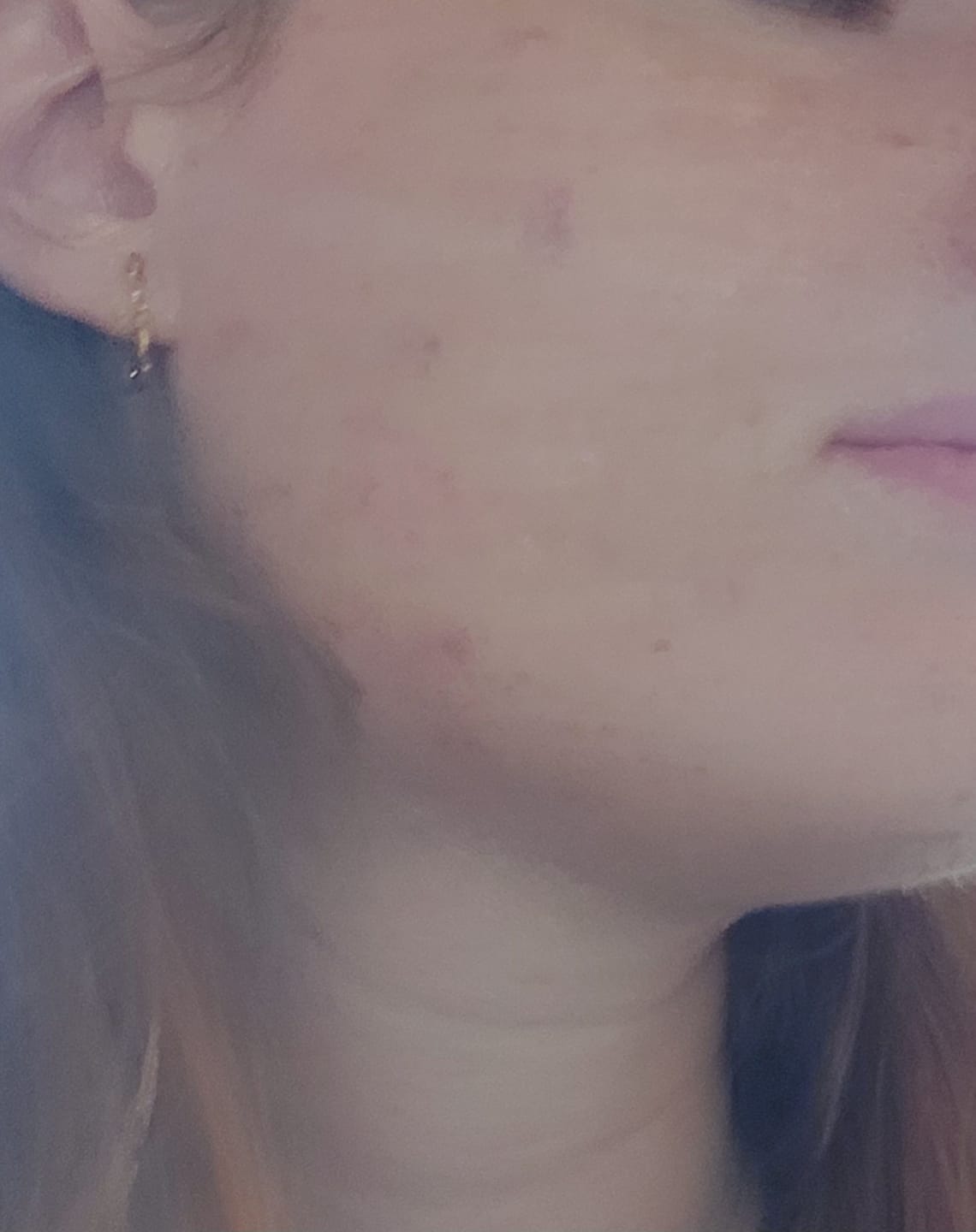 Customer photo review of TuumBiome Pattanás Elleni Gél Fágtechnológiával