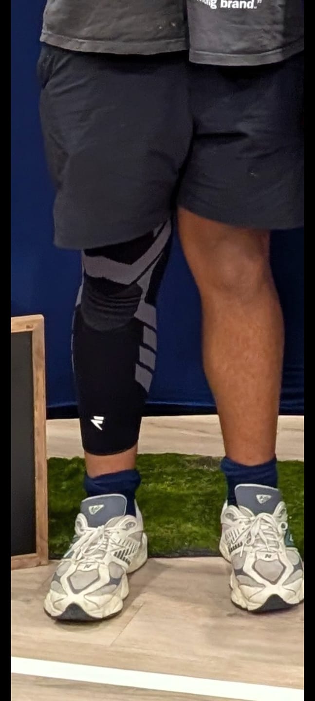 Customer photo review of Compression Sleeves V2 for Knees and Legs