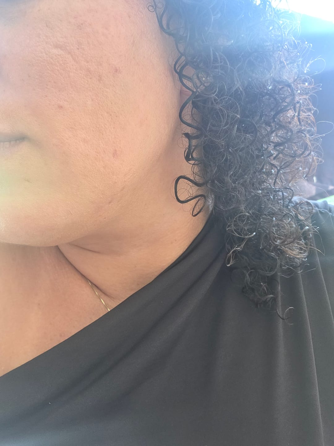 Customer photo review of Creme Clareador de Manchas – Melasma, Axilas, Virilha, Áreas Íntimas, Rosto e Corpo