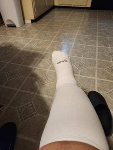 Customer photo review of Original Wide Compression Socks