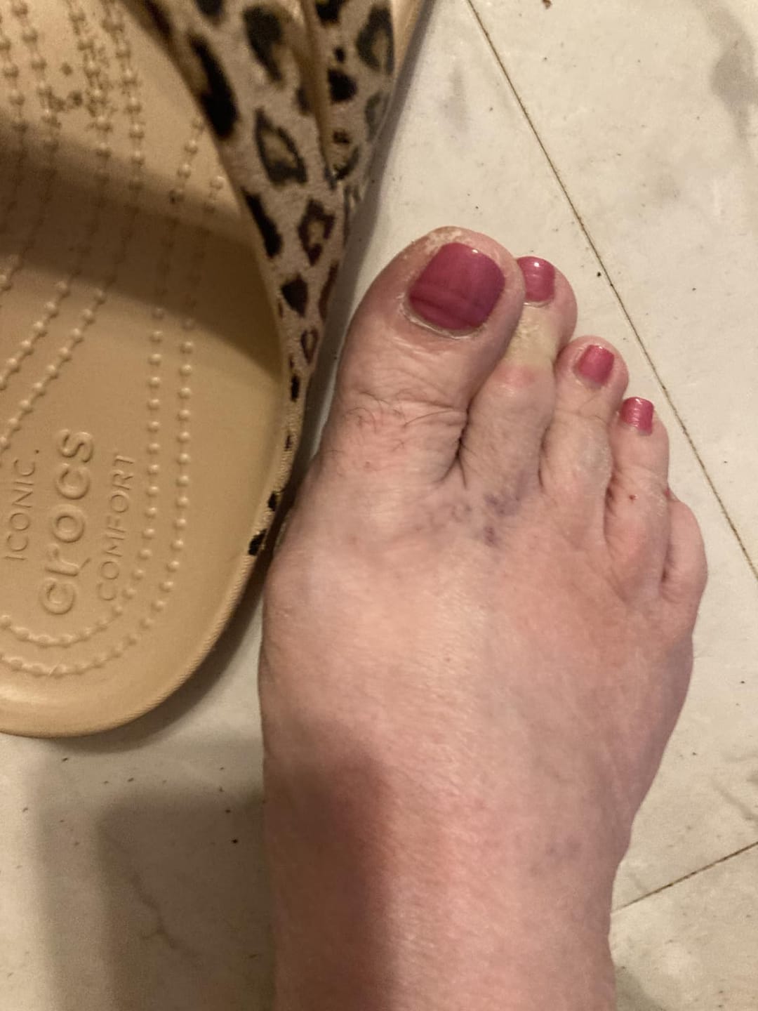 Customer photo review of משחה להקלה בכאבי דורבן
