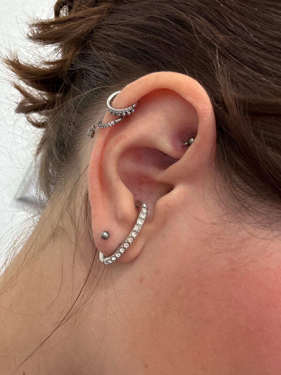 Customer photo review of Simple Labret Piercing - Titan