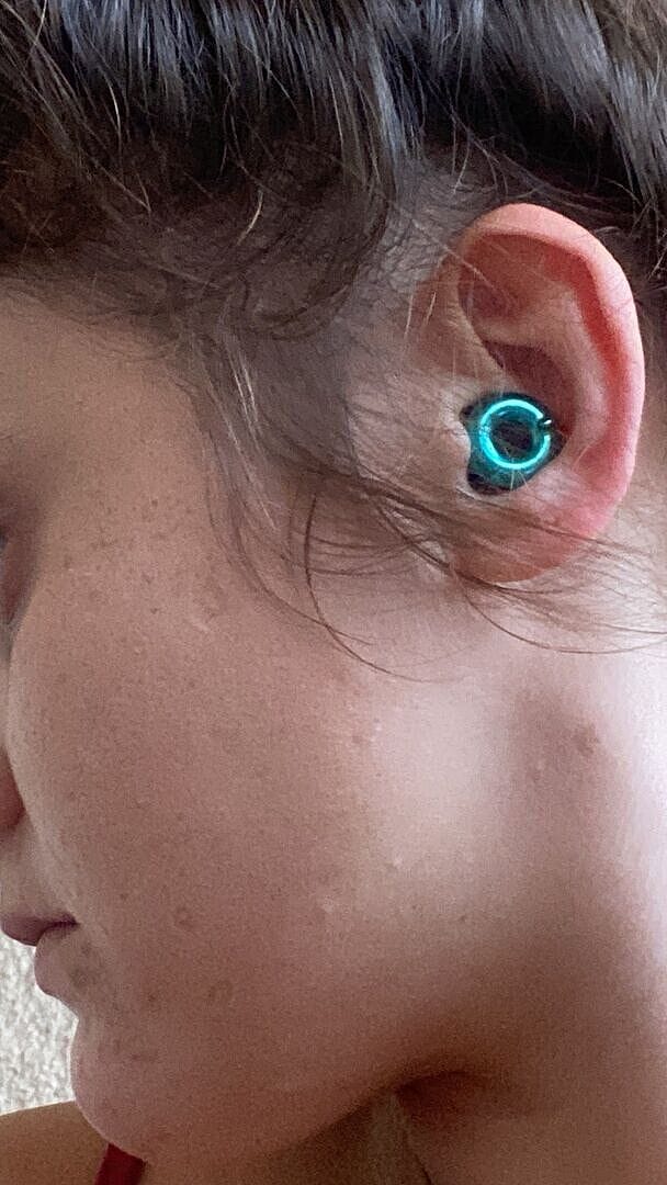 Customer photo review of Loop Switch™ 2