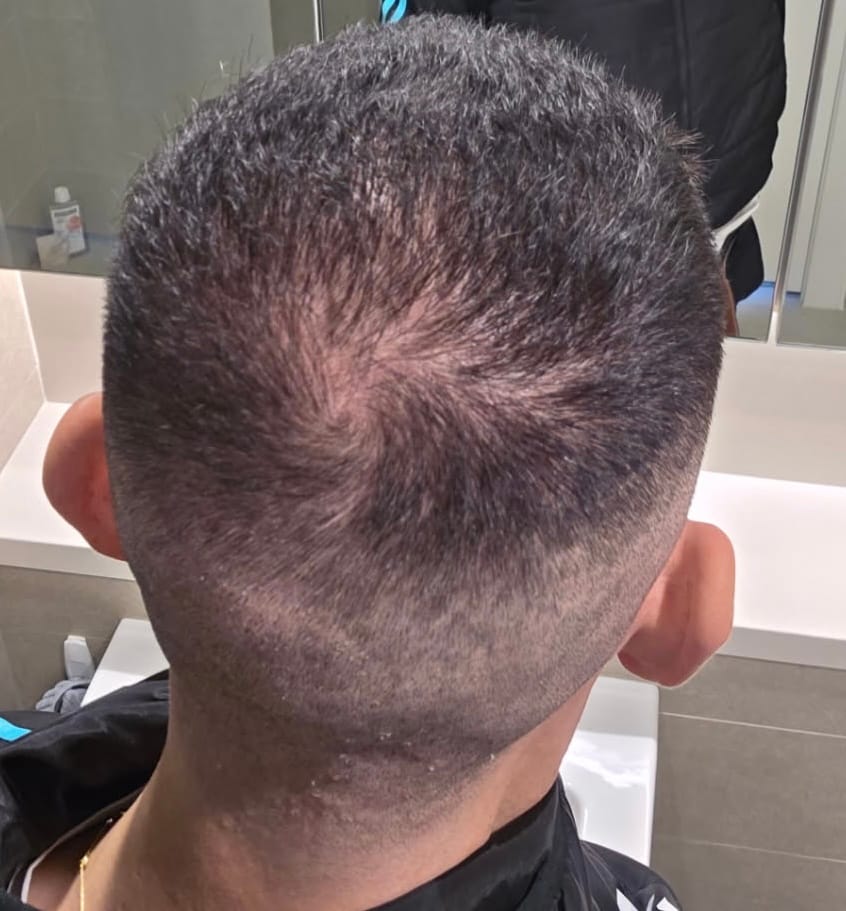 Customer photo review of Hair Growth Oil