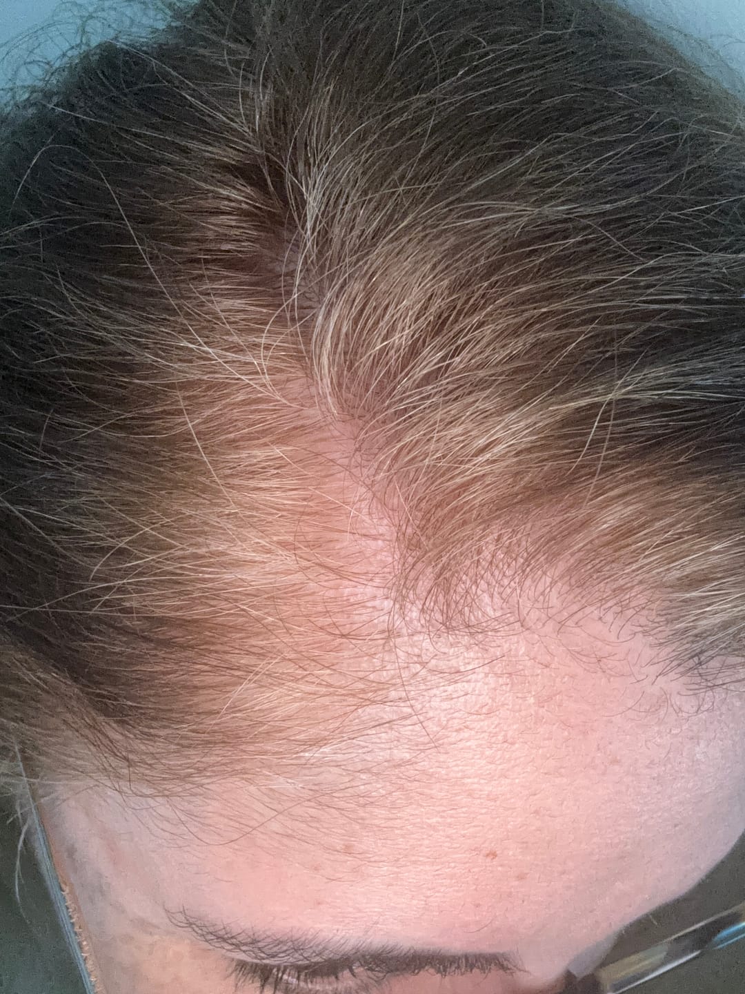 Customer photo review of Instant Dye Shampoo