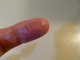 Customer photo review of LumiClear™ Dark Spot Serum
