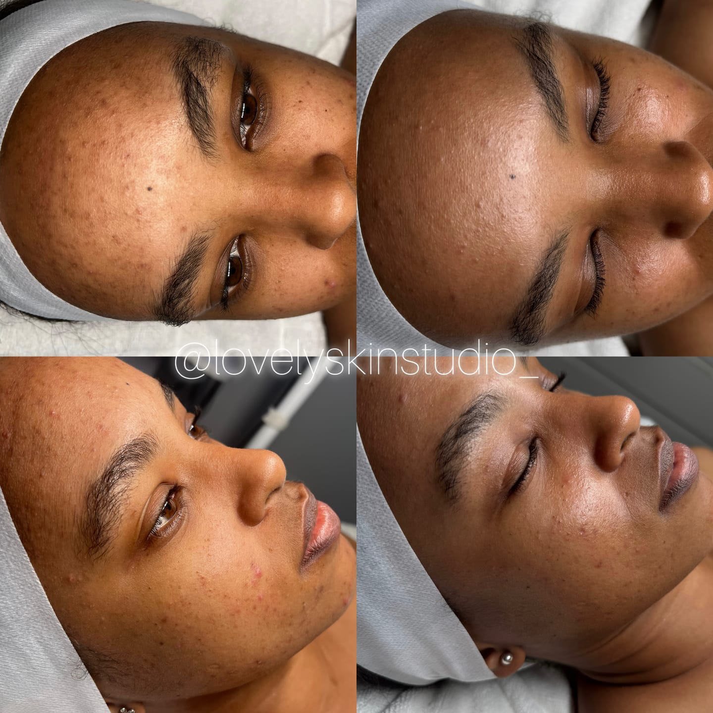 Customer photo review of Zena 100% Organic Algae Peel
