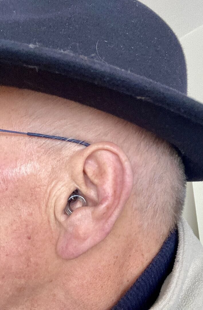 Customer photo review of Loop Engage™ 2