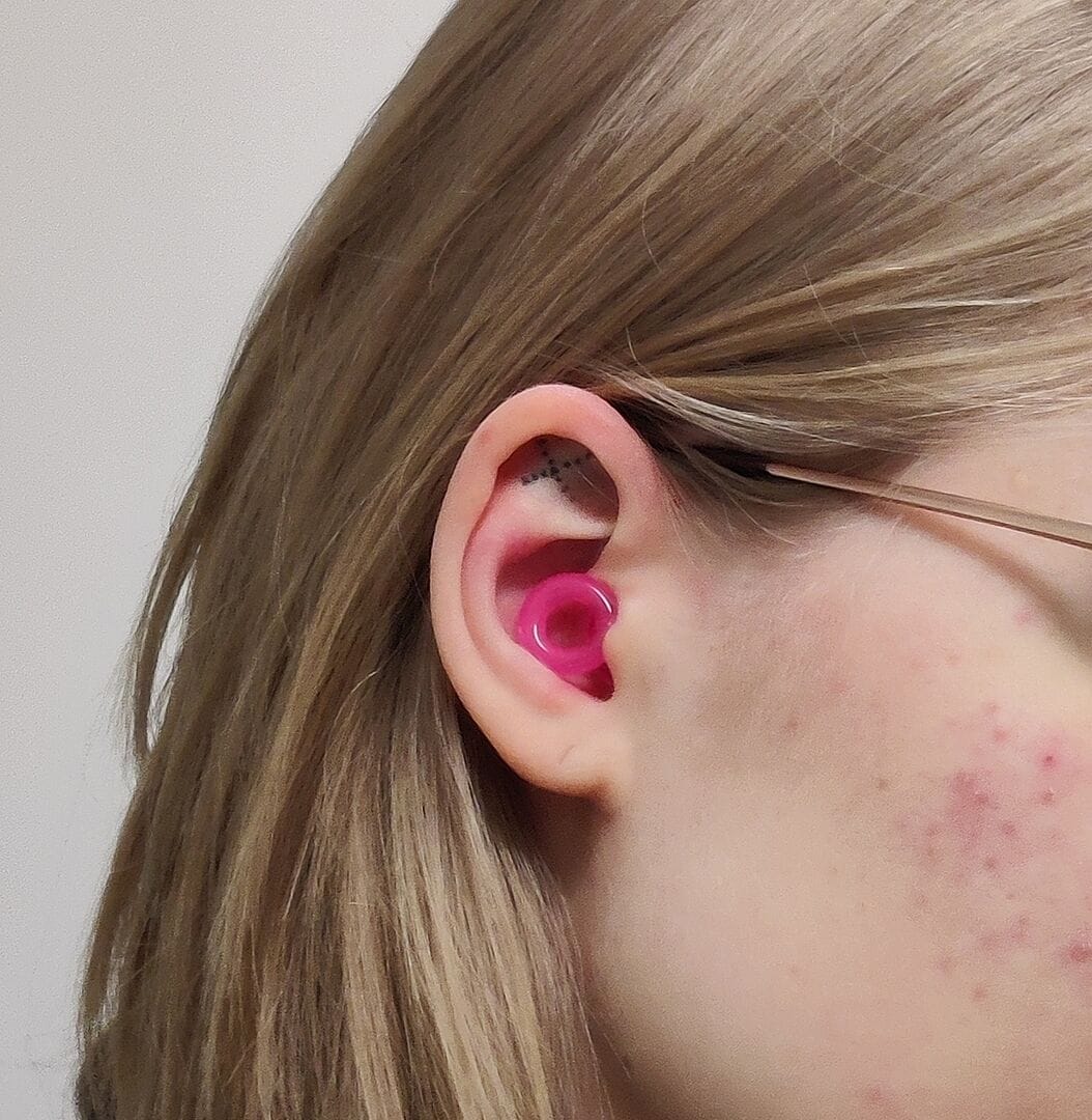 Customer photo review of Engage Equinox
