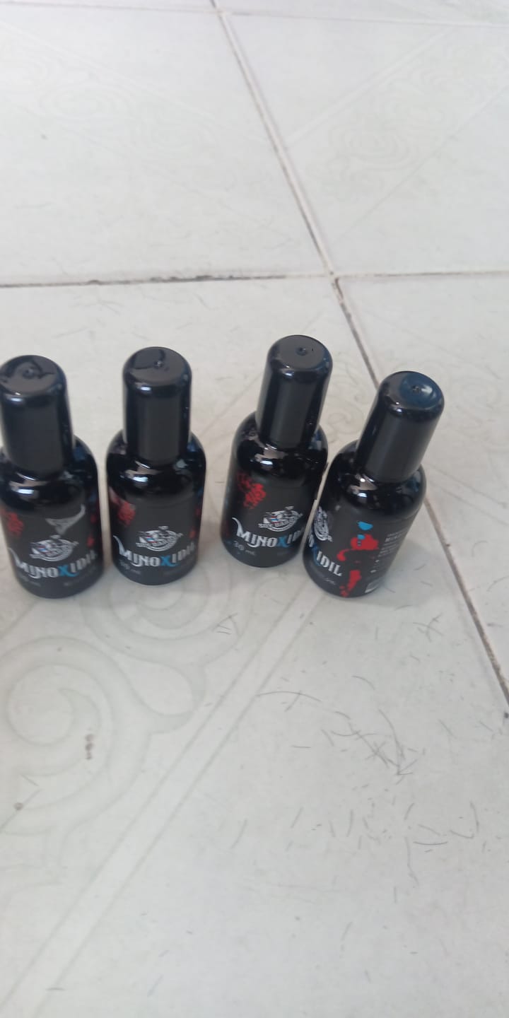 Customer photo review of Soy Barber - Minoxidil 30ml