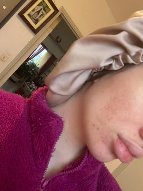 Customer photo review of Melira™