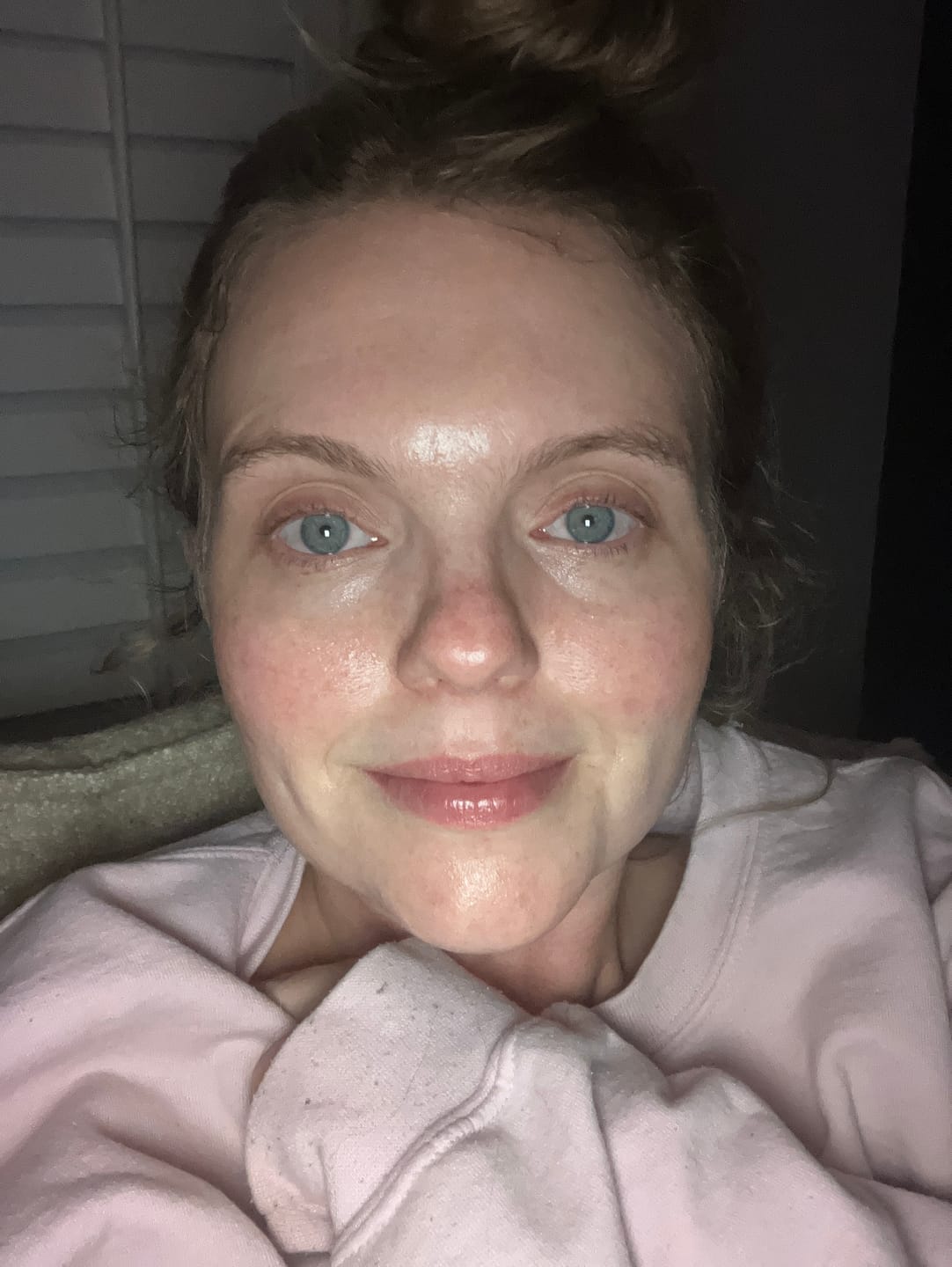 Customer photo review of Facial Moisturizing Cream