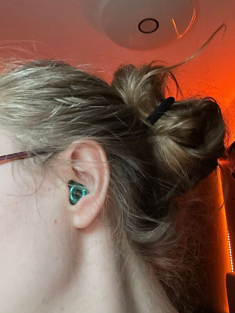 Customer photo review of Loop Switch™ 2