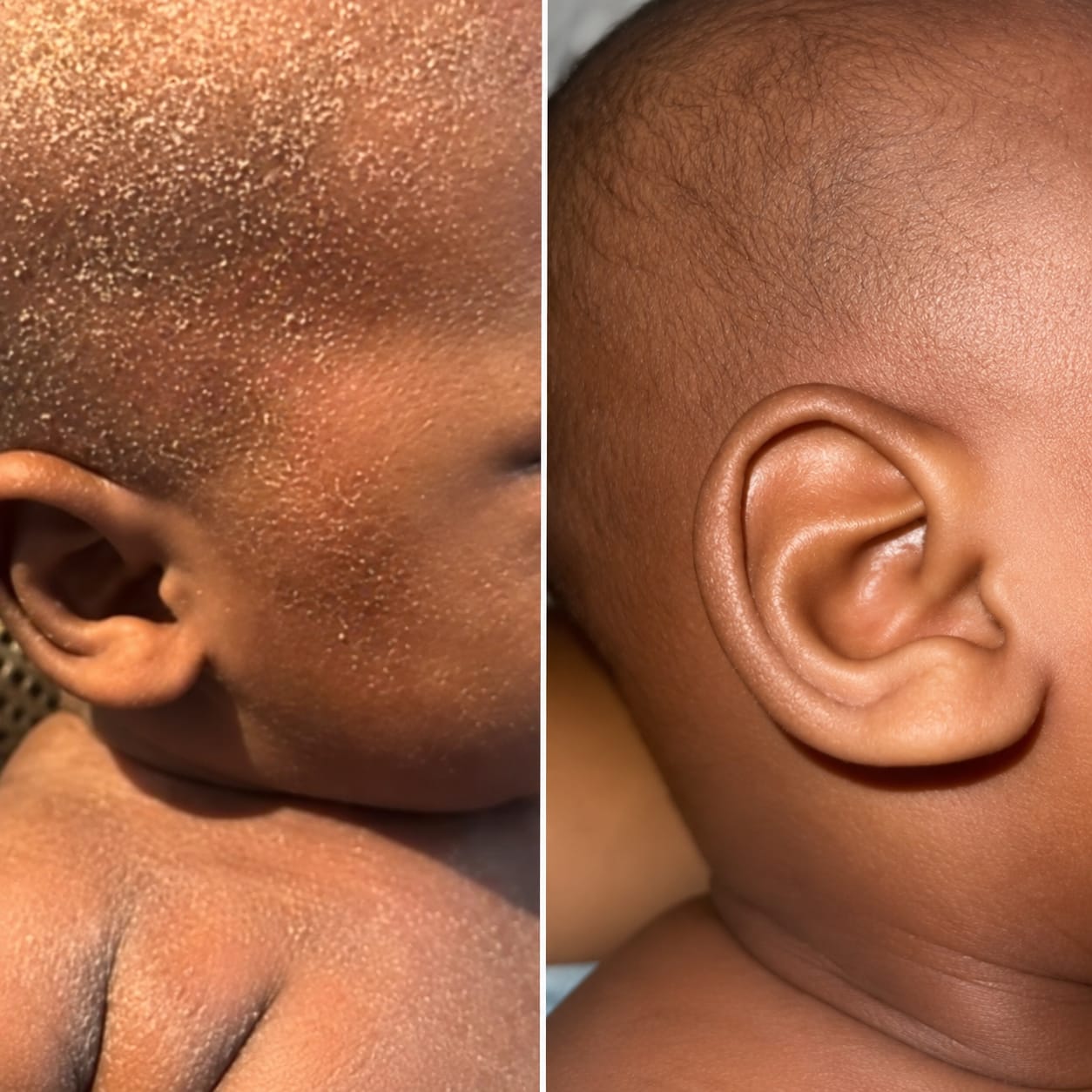 Customer photo review of NAMASA™ Crema de Miel para Eczema