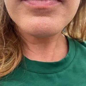 Customer photo review of Aurelia Sleep — Queen Tape™