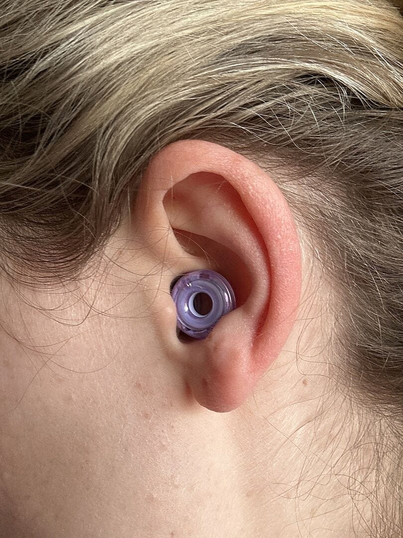 Customer photo review of Loop Switch™ 2
