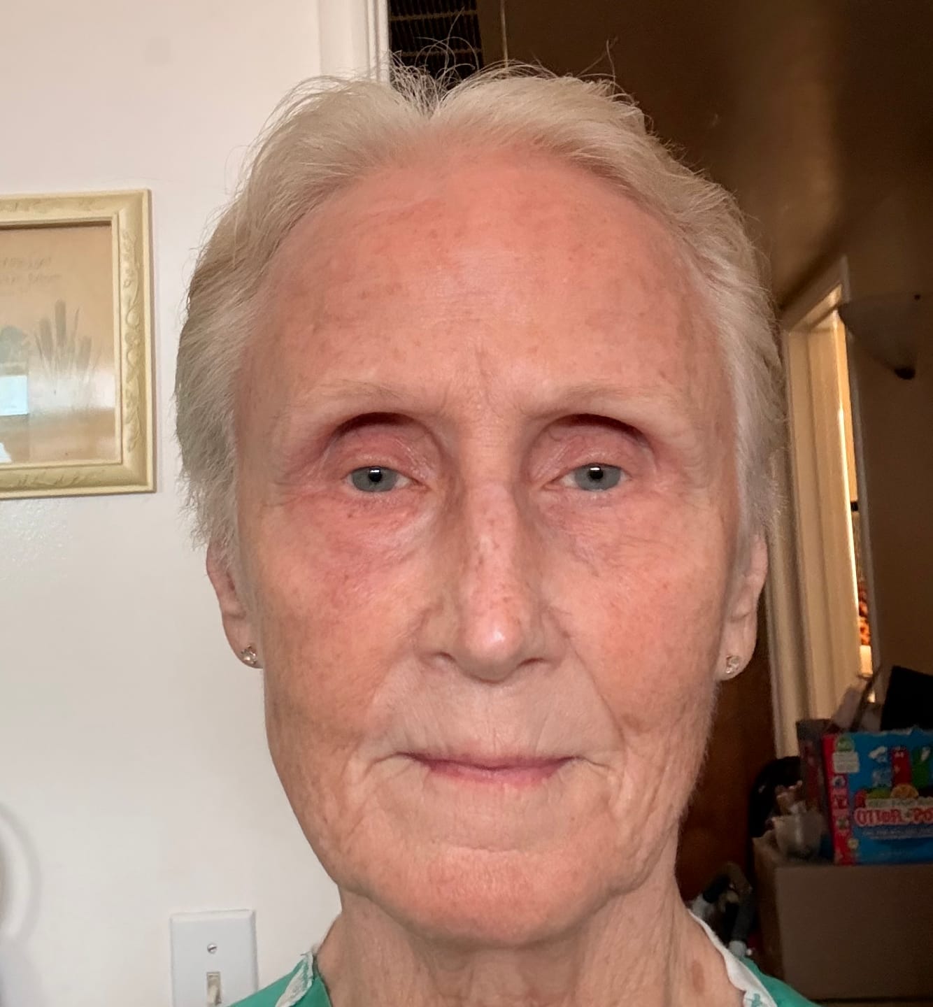 Customer photo review of INIA GLOW 4D 940nm Dual NIR Wireless LED Mask