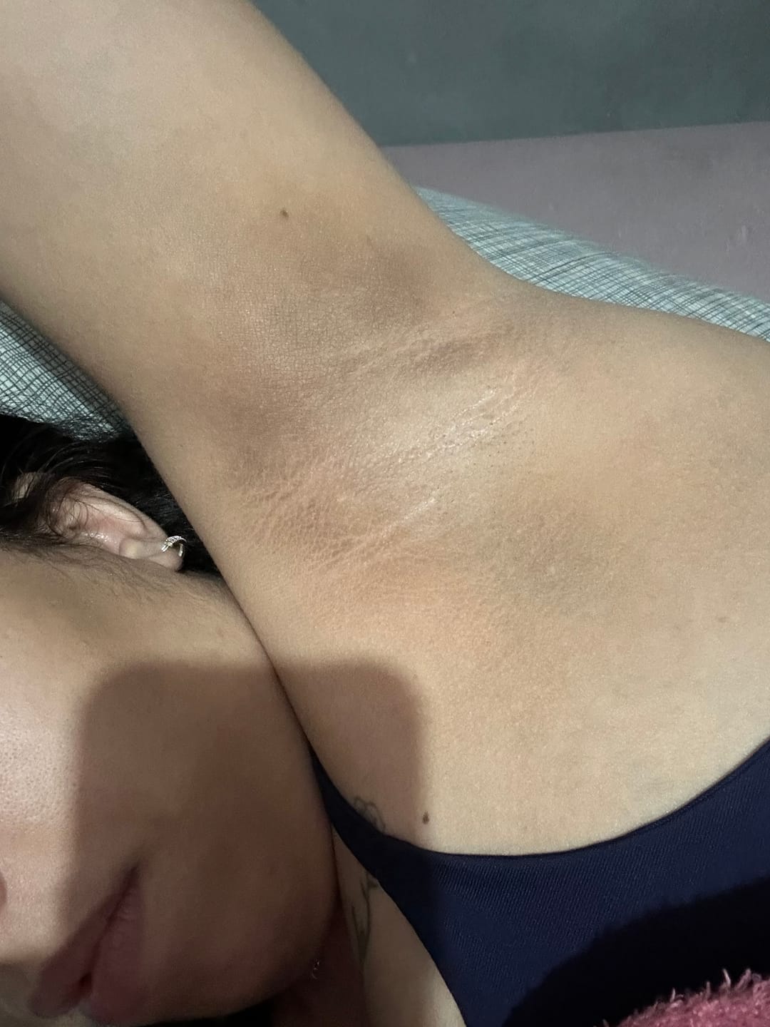 Customer photo review of Creme Clareador de Manchas – Melasma, Axilas, Virilha, Áreas Íntimas, Rosto e Corpo
