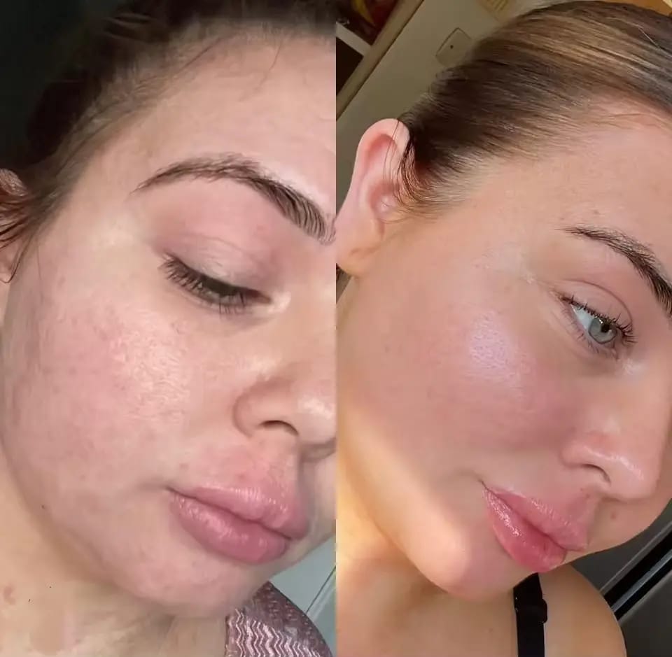 Customer photo review of NIDA Salmon PDRN Peptide Serum