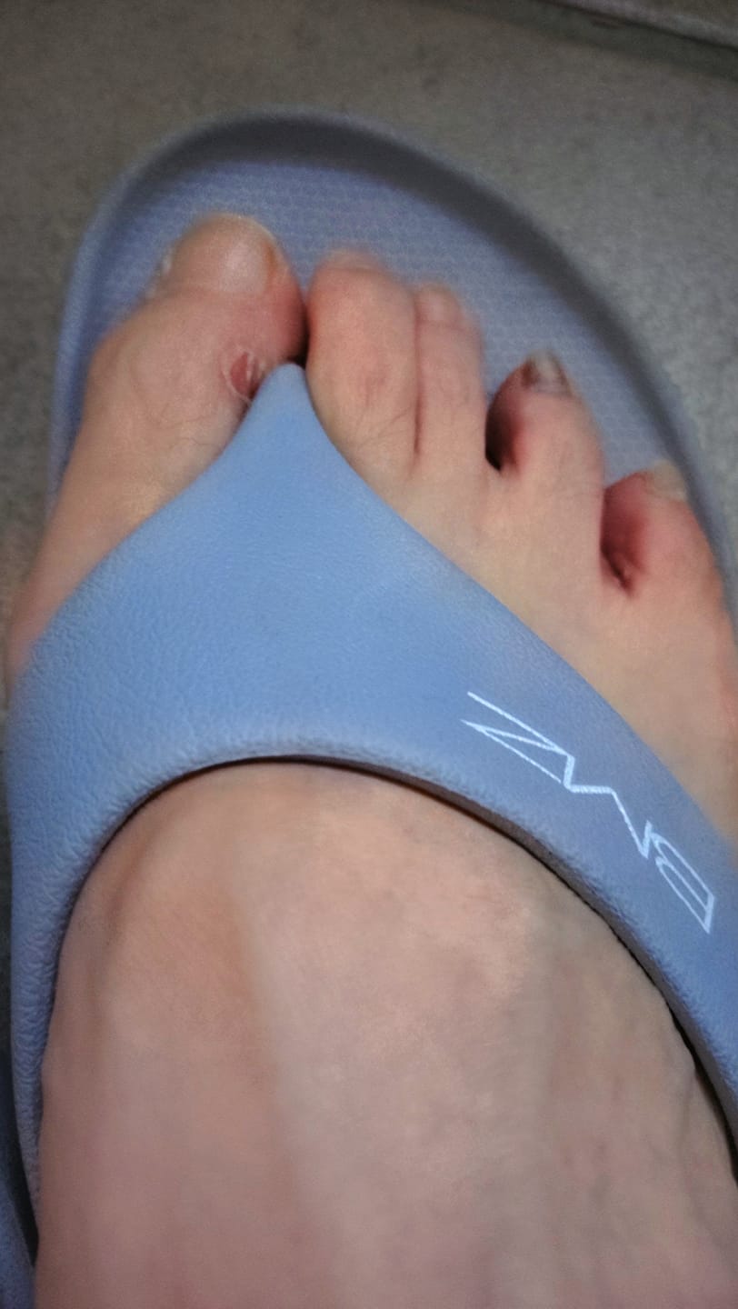 Customer photo review of アシトレマジックスタンダード