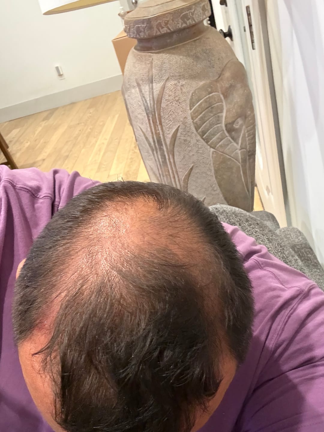 Customer photo review of Spartan™ Root Activator Shampoo 1 Bottle + Shipping(sc)