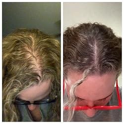 Customer photo review of Hair Control - Shampoo Anticaída