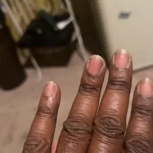 Customer photo review of 2-in-1 Cuticle Care Pen