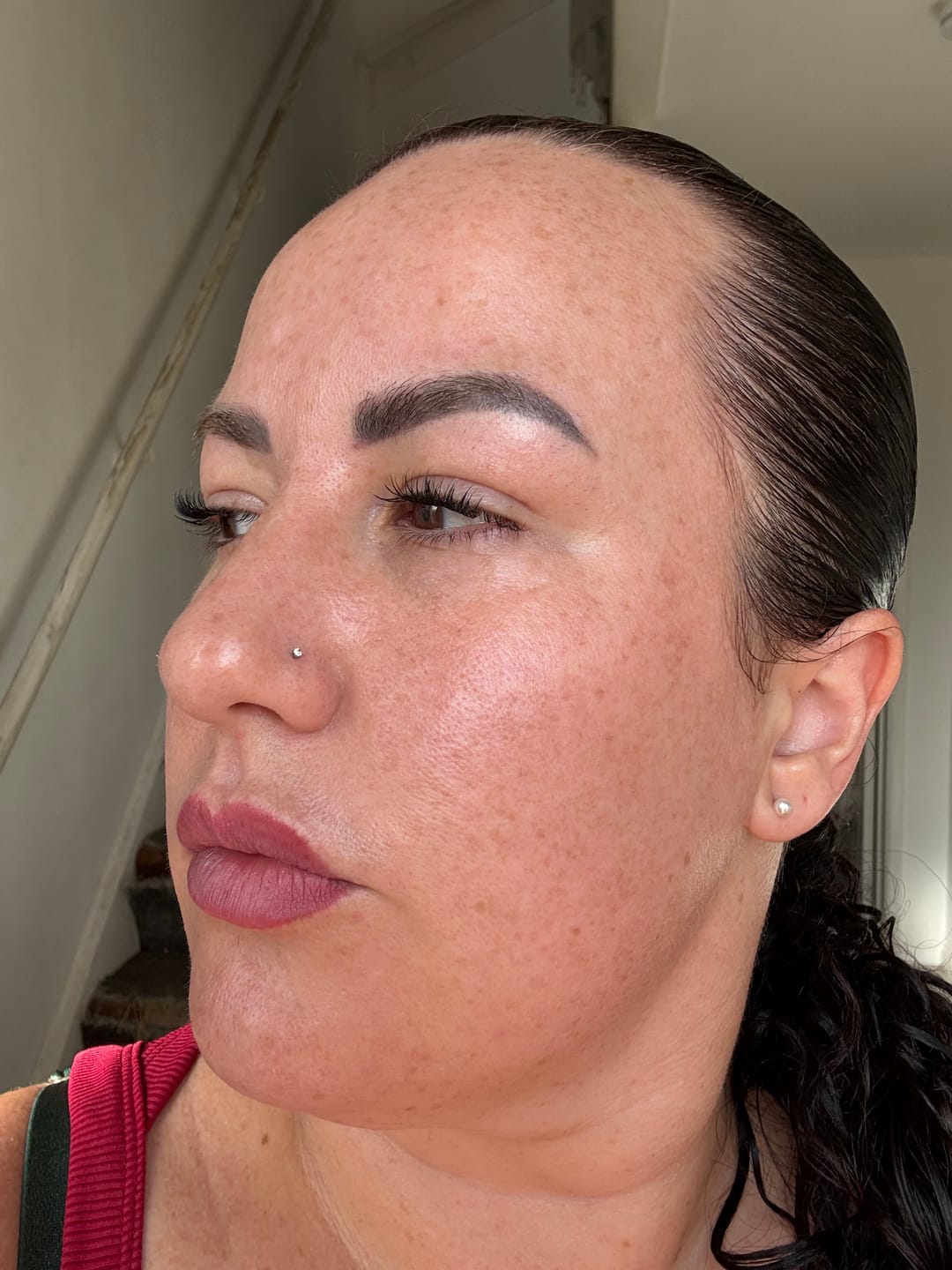 Customer photo review of Dr. Pen H6 Advanced Serum Infusion Microneedling Pen with Light Therapy