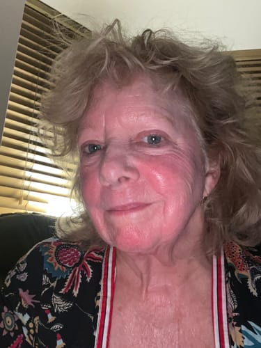 Customer's face after using the Micro Infusion System, showing slightly flushed skin.