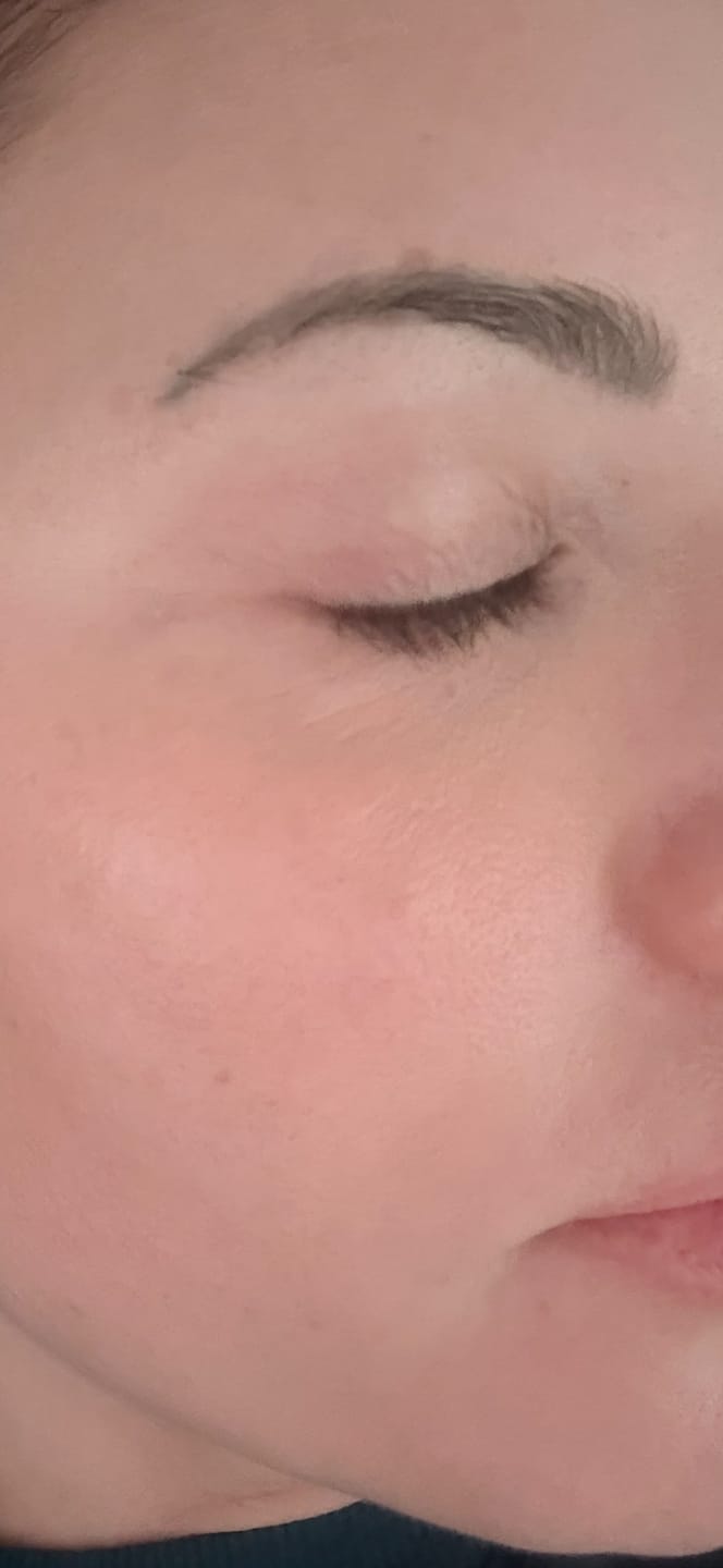 Customer photo review of The Naked Skin™ Bounce Balm