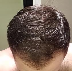 Customer photo review of Hair Control - Shampoo Anticaída